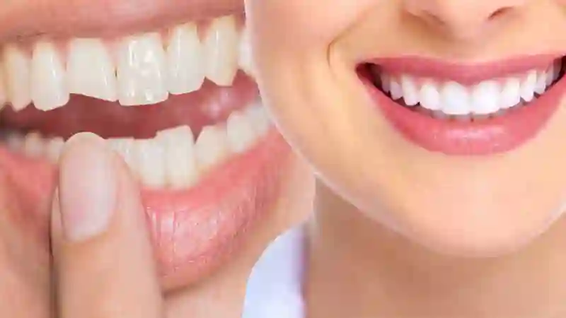 Cosmetic Dentistry