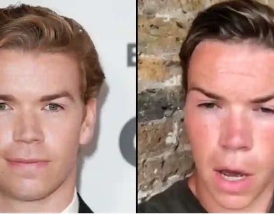 Actor