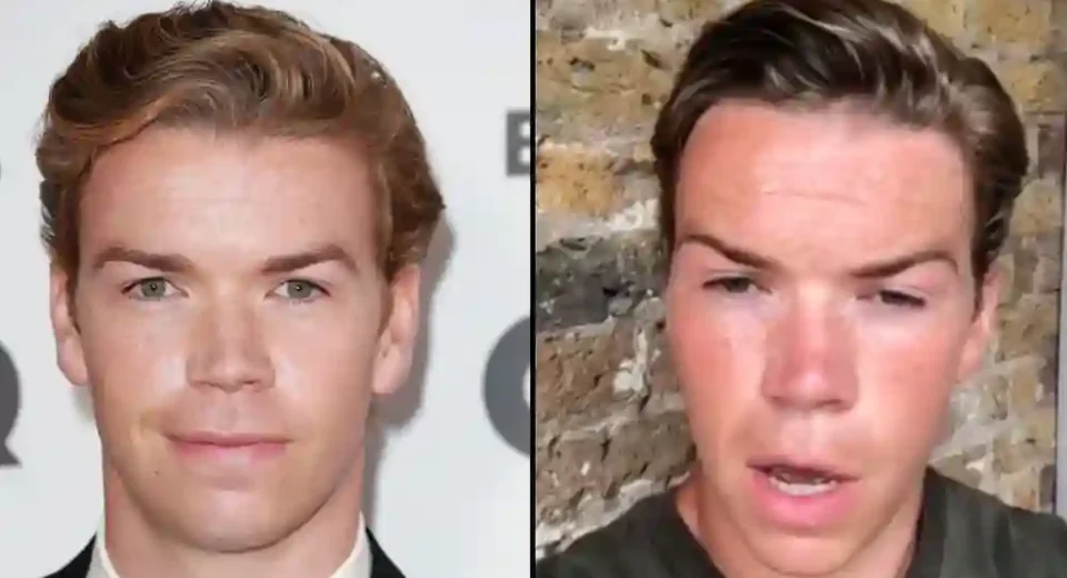 Actor